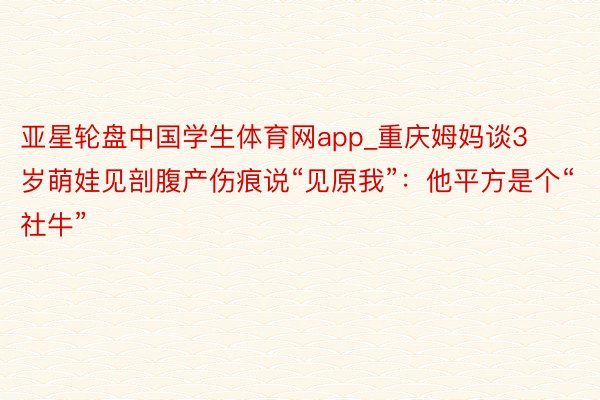 亚星轮盘中国学生体育网app_重庆姆妈谈3岁萌娃见剖腹产伤痕说“见原我”：他平方是个“社牛”